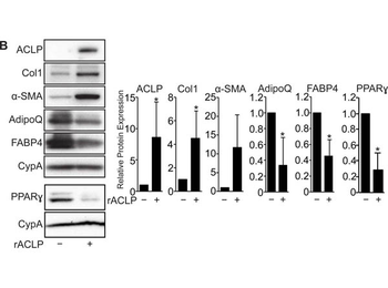 COL1A1/A2 Antibody