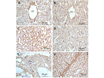 COL1A1/A2 Antibody