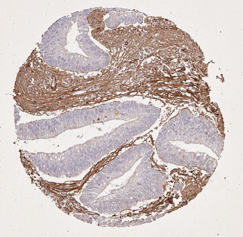 COL1A1/A2 Antibody