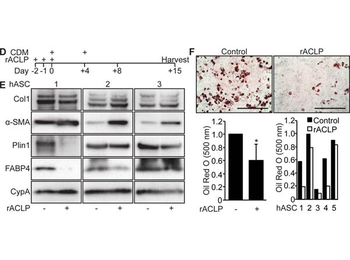 COL1A1/A2 Antibody