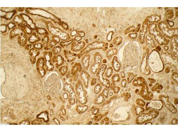 COL1A1/A2 Antibody