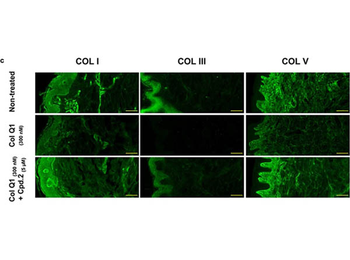 COL1A1/A2 Antibody