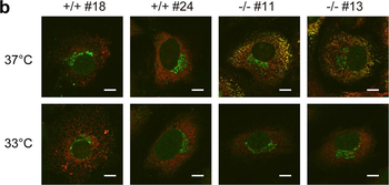 COL1A1/A2 Antibody