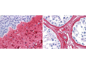 COL3A1 Antibody