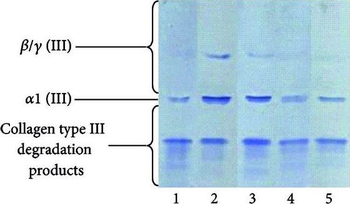 COL3A1 Antibody