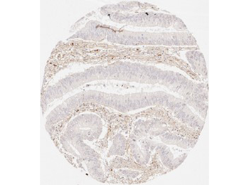 COL3A1 Antibody