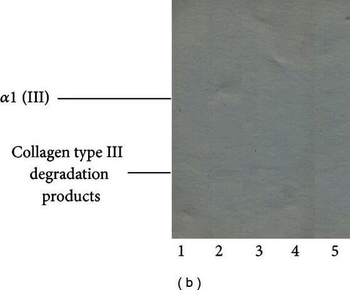 COL3A1 Antibody