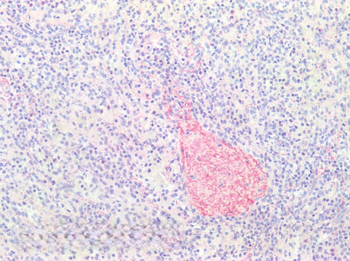 COL3A1 Antibody