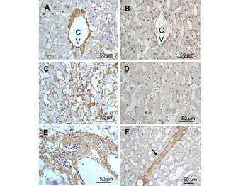 COL3A1 Antibody