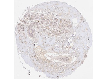 COL3A1 Antibody