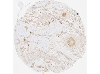 COL3A1 Antibody