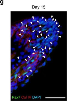 COL4A1-COL4A6 Antibody