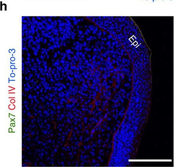 COL4A1-COL4A6 Antibody