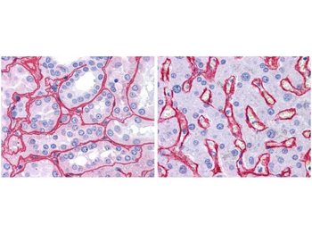COL4A1-COL4A6 Antibody