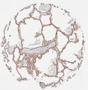 COL4A1-COL4A6 Antibody