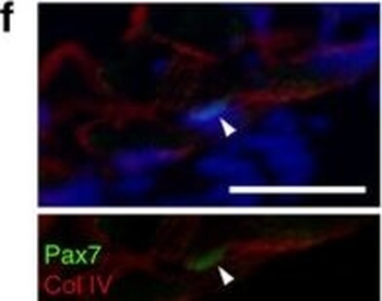 COL4A1-COL4A6 Antibody