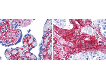 COL6A1-COL6A3 Antibody