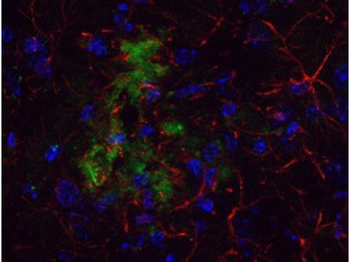 APP Antibody