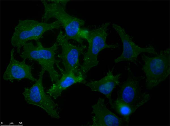 APP Antibody