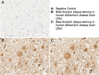 APP Antibody