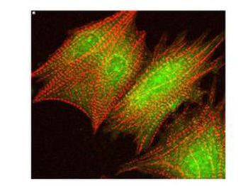 AKT1 Antibody