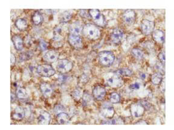 AKT1 Antibody