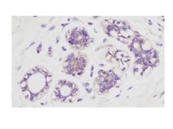 AKT1 Antibody