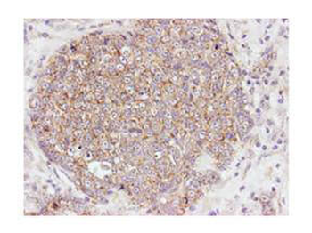 AKT1 Antibody