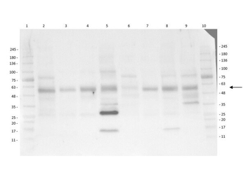 AKT1 Antibody