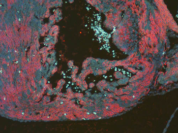 DsRed Antibody