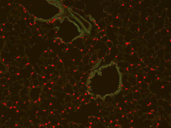 DsRed Antibody
