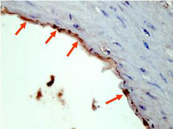 HA Epitope Tag Antibody