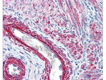 MYL12A Antibody