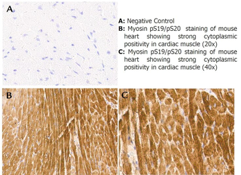 MYL12A Antibody