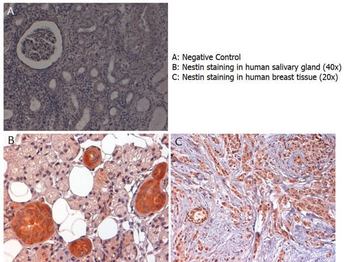 NES Antibody