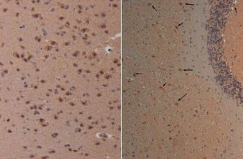 NES Antibody