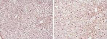 Ppara Antibody