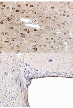 Ppara Antibody