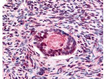 GSK3B Antibody