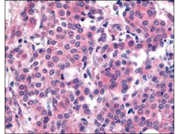 PLK1 Antibody