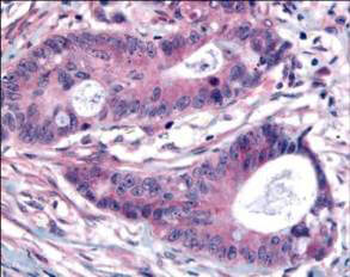 PLK1 Antibody