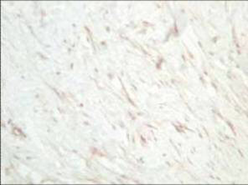 SFRP1 Antibody