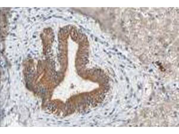FBXO5 Antibody