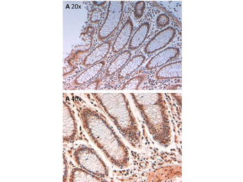 AURKB Antibody