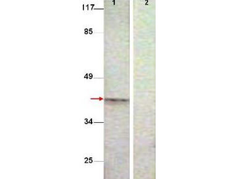 AURKB Antibody