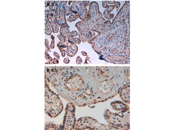 AURKB Antibody