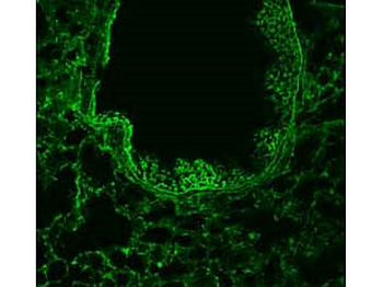 ROBO1 Antibody