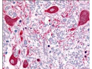 ROBO1 Antibody