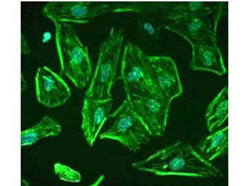 ROBO1 Antibody