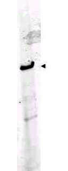 ROBO1 Antibody